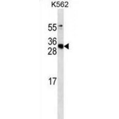 Serum Amyloid P-Component (APCS) Antibody