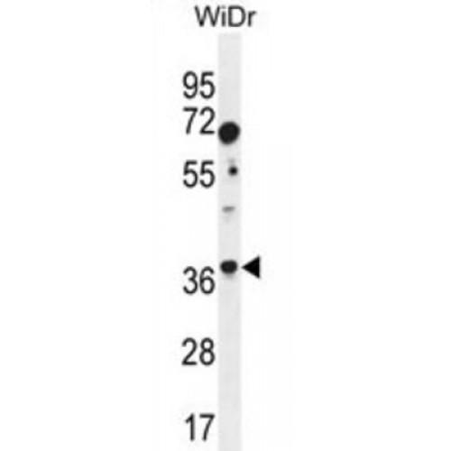 Aldolase C, Fructose Bisphosphate (ALDOC) Antibody
