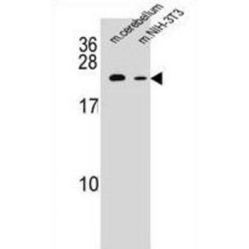RAB12, Member RAS Oncogene Family (RAB12) Antibody