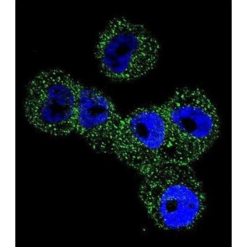 Serpin B5 (SERPINB5) Antibody