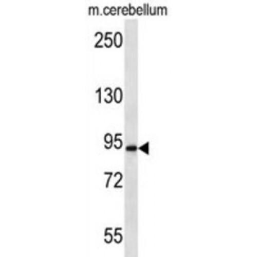 Amyloid-Beta A4 Precursor Protein-Binding Family A Member 2 (APBA2) Antibody