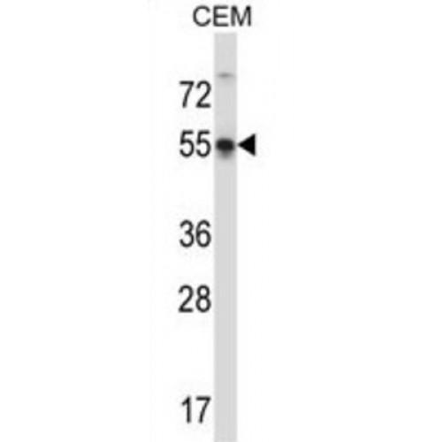 POU Class 3 Homeobox 3 (POU3F3) Antibody