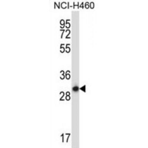 Syntaxin-17 (STX17) Antibody