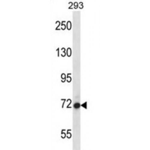 Arf-GAP With GTPase, ANK Repeat And PH Domain-Containing Protein 4 (AGAP4) Antibody