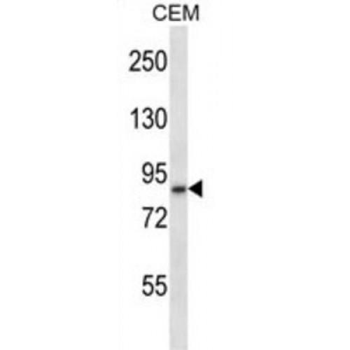 Disintegrin And Metalloproteinase Domain-Containing Protein 11 (ADAM11) Antibody