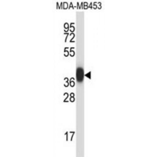 Protease, Serine 8 (PRSS8) Antibody