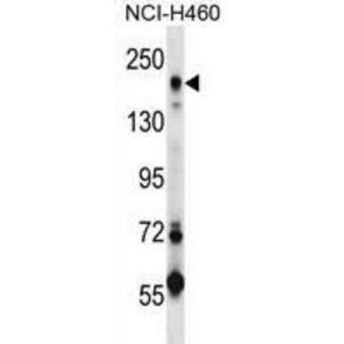 Mannose Receptor C Type 2 (MRC2) Antibody