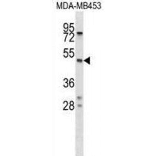 Protein C Inhibitor (SERPINA5) Antibody