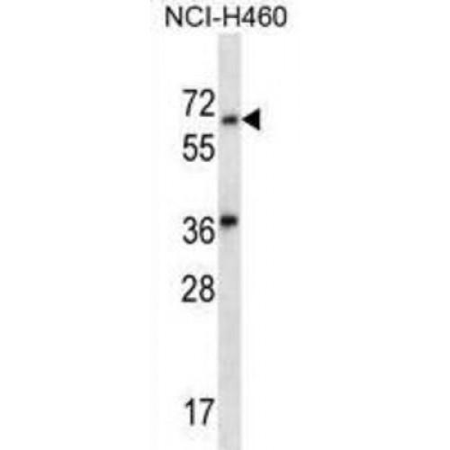 Leucine-Rich Repeat And Immunoglobulin-Like Domain-Containing Nogo Receptor-Interacting Protein 3 (LINGO3) Antibody