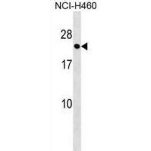 RAB41, Member RAS Oncogene Family (RAB41) Antibody