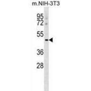 Macrophage Scavenger Receptor 1 (MSR1) Antibody