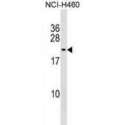 FUN14 Domain Containing 1 (FUNDC1) Antibody