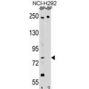 DCC-Interacting Protein 13-Beta (APPL2) Antibody