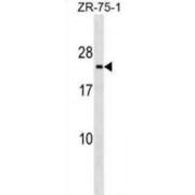 Transmembrane P24 Trafficking Protein 3 (TMED3) Antibody