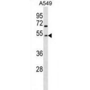 N-Acetyllactosaminide Beta-1,6-N-Acetylglucosaminyl-Transferase (GCNT2) Antibody