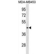 ALG8, Alpha-1,3-Glucosyltransferase (ALG8) Antibody