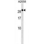 RAB7B, Member RAS Oncogene Family (RAB7B) Antibody