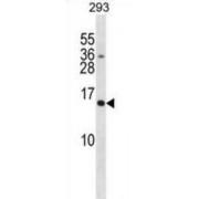 SH2 Domain Containing 1A (SH2D1A) Antibody