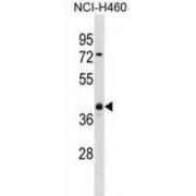Ubiquitin Carboxyl Terminal Hydrolase L5 (UCHL5) Antibody