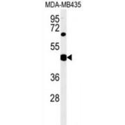 SH2 Domain Containing 2A (SH2D2A) Antibody