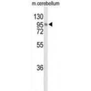 Leucine-Rich Repeat Neuronal Protein 1 (LINGO1) Antibody