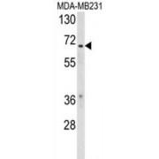 Retinoic Acid Receptor RXR-Beta (RXRB) Antibody