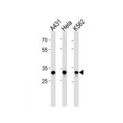 Amyloid Beta Precursor Protein Binding Protein B3 (APBB3) Antibody