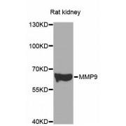 Matrix Metalloproteinase-9 (MMP9) Antibody