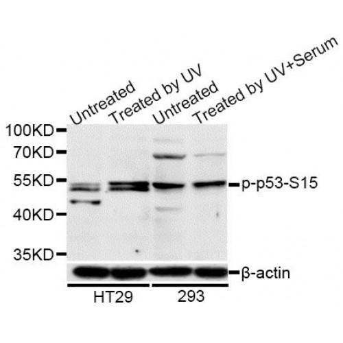 p53 Phospho-Ser15 (p53 pS15) Antibody