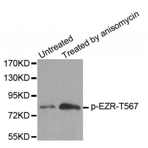 EZR (pT567) Antibody