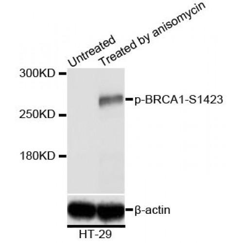 Breast Cancer Type 1 Susceptibility Protein Phospho-Ser1423 (BRCA1 pS1423) Antibody