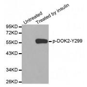 DOK2 (pY299) Antibody