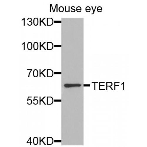 Telomeric Repeat-Binding Factor 1 (TERF1) Antibody