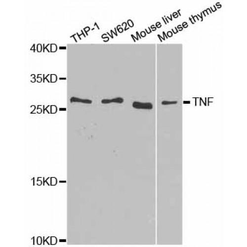 Tumor Necrosis Factor (TNF) Antibody