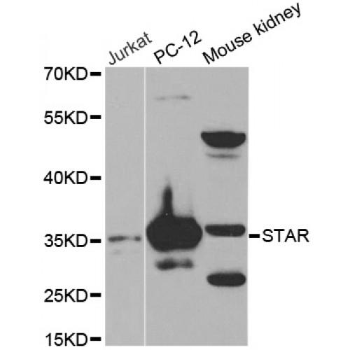 Steroidogenic Acute Regulatory Protein, Mitochondrial (STAR) Antibody