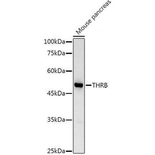 Thyroid Hormone Receptor Beta (THRB) Antibody