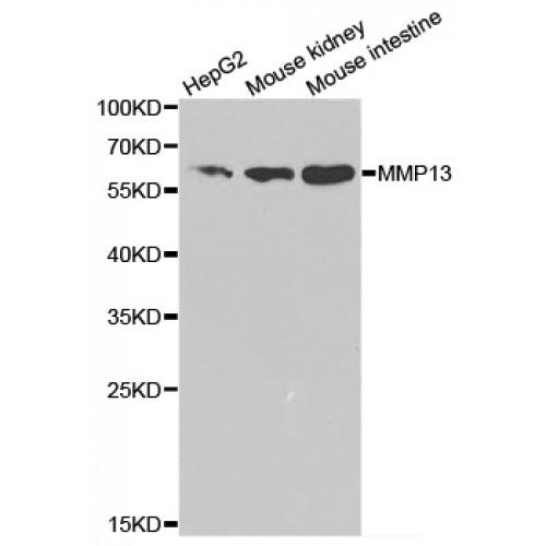 Matrix Metalloproteinase 13 (MMP13) Antibody