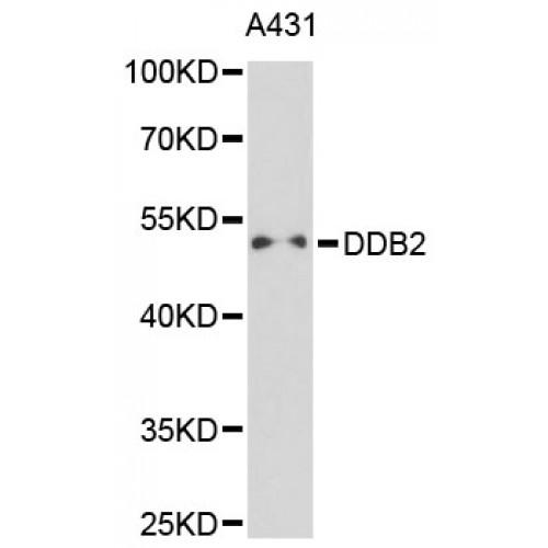 DNA Damage-Binding Protein 2 (DDB2) Antibody