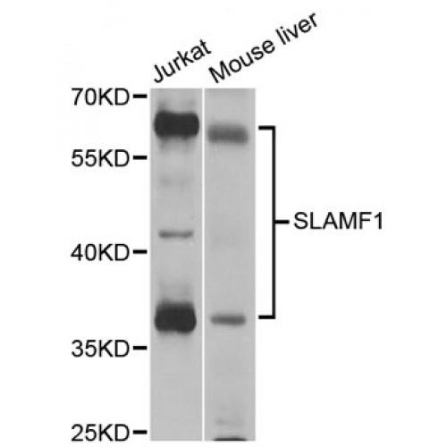 Signaling Lymphocytic Activation Molecule Family Member 1 / CD150 (SLAMF1) Antibody