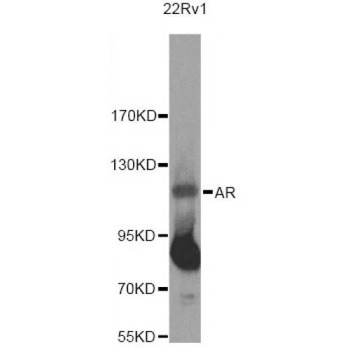 Androgen Receptor (AR) Antibody