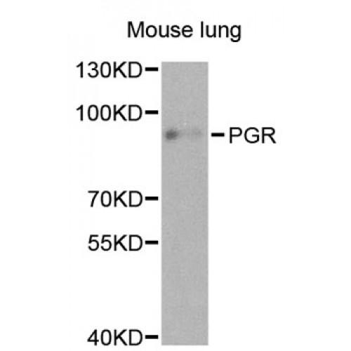 Progesterone Receptor (PGR) Antibody