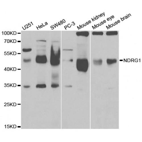 Protein NDRG1 (NDRG1) Antibody