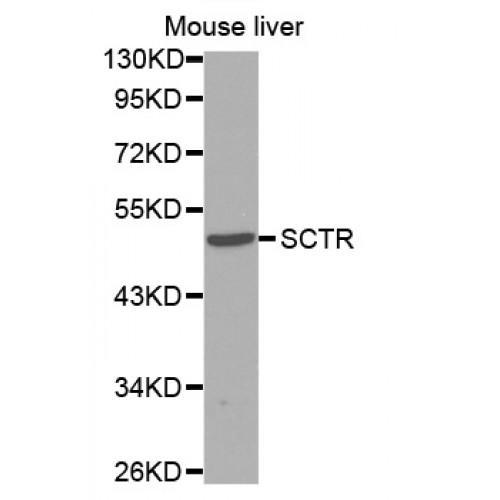 Secretin Receptor (SCTR) Antibody