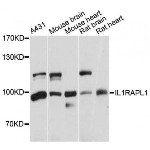 Interleukin 1 Receptor Accessory Protein Like 1 (IL1RAPL1) Antibody