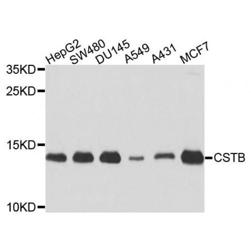 Cystatin-B (CSTB) Antibody