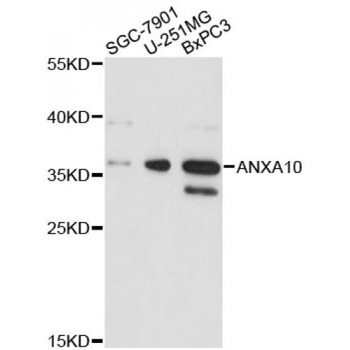 Annexin A10 (ANXA10) Antibody