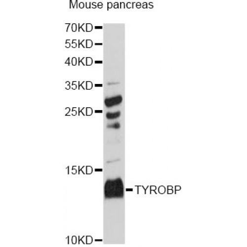 TYRO Protein Tyrosine Kinase Binding Protein (TYROBP) Antibody