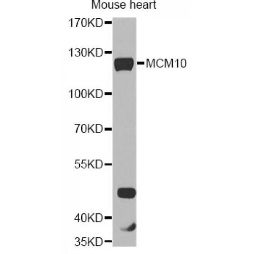 MCM10 Minichromosome Maintenance Deficient 10 (MCM10) Antibody