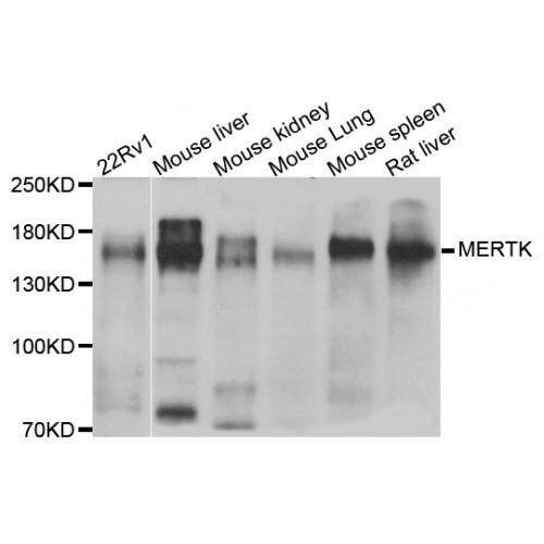 Tyrosine-Protein Kinase Mer (MERTK) Antibody