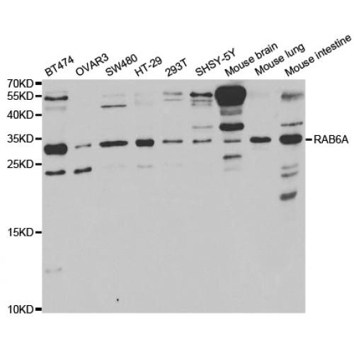 RAB6A, Member RAS Oncogene Family (RAB6A) Antibody
